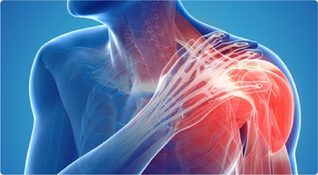 Can A Pulled Back Muscle Cause Chest Pain